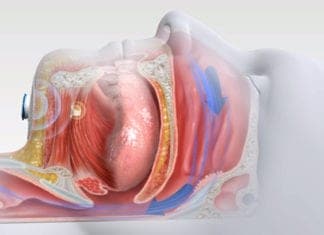 How Sleep Apnea Can Impact Learning Podcast