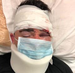 Sheriff’s Deputy Assaulted at Vista Jail