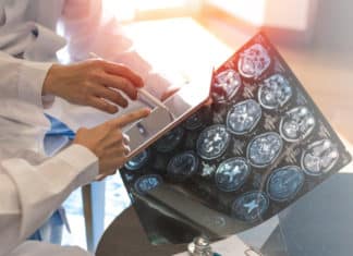 Tri-City Medical Center Integrates AI Technology in its Stroke Care Services Because “Time is Brain”