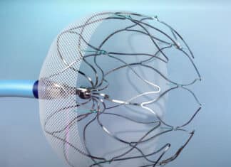 Tri-City Medical Center Celebrates 100th Watchman Procedure for Atrial Fibrillation