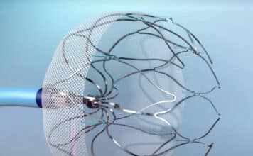 Tri-City Medical Center Celebrates 100th Watchman Procedure for Atrial Fibrillation