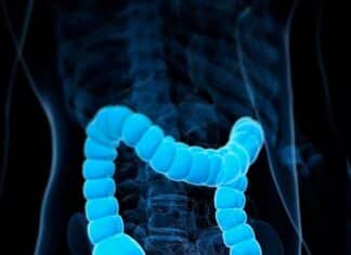 Why Colorectal Cancer Screenings Matter