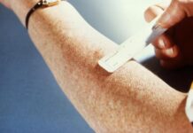 Multi-Drug Resistant TB Exposure Reported at California State University San Marcos and Sprinter Train