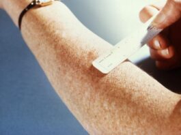 Multi-Drug Resistant TB Exposure Reported at California State University San Marcos and Sprinter Train