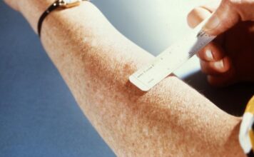 Multi-Drug Resistant TB Exposure Reported at California State University San Marcos and Sprinter Train