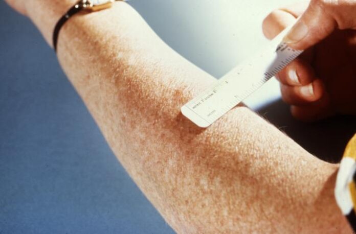 CDCTBTest-1